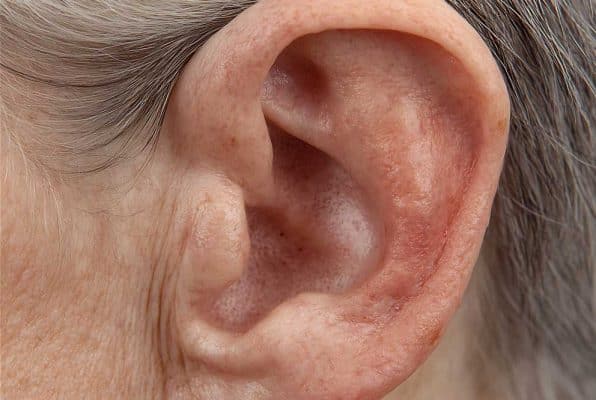 Photo of an ear